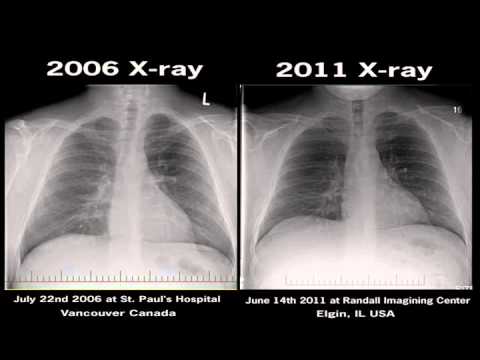 electronic cigarette